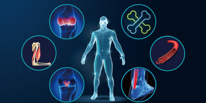 怪我の84％が減少